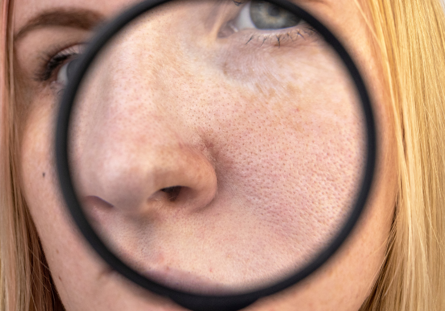 DAEBLOG: The K-Beauty Guide to Managing Sebaceous Filaments