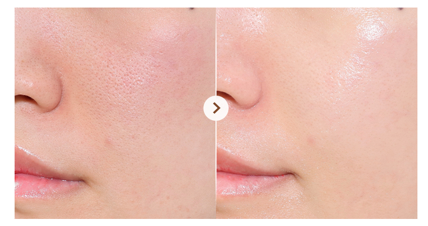 Before and after comparison of a person's skin on a white background